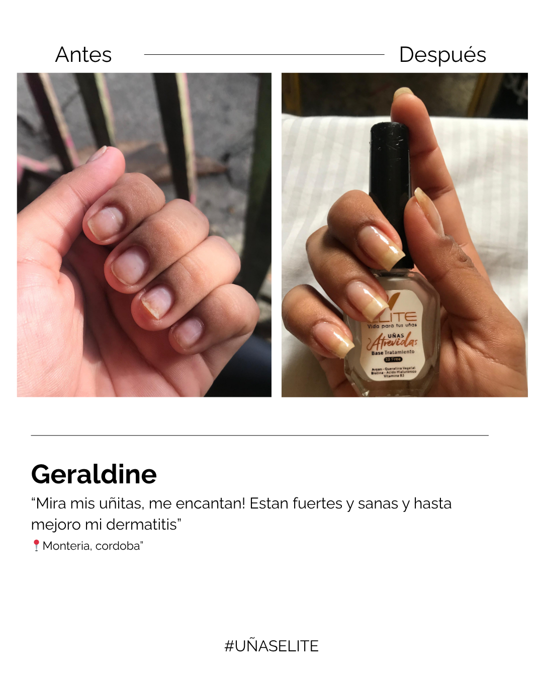 BASE TRATAMIENTO “UÑAS ATREVIDAS”