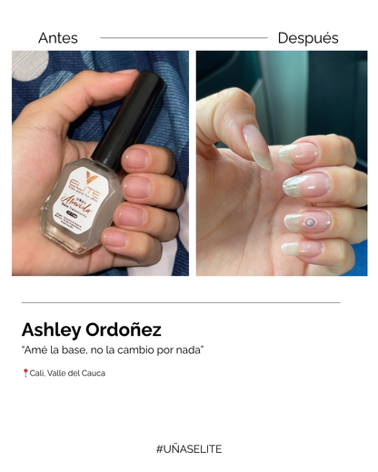 BASE TRATAMIENTO “UÑAS ATREVIDAS”