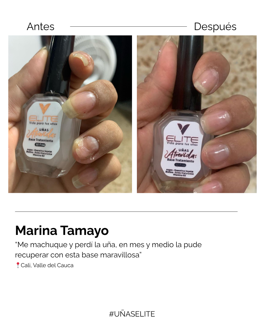 BASE TRATAMIENTO “UÑAS ATREVIDAS”